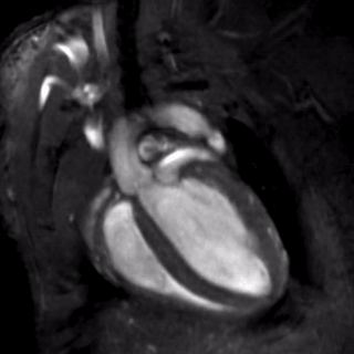Mouse heart MRI