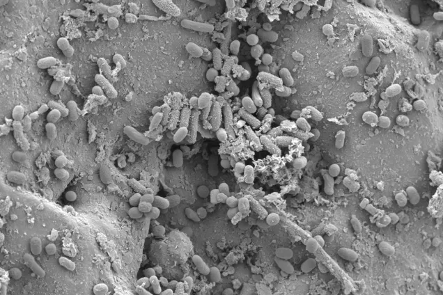E coli bacteria. SEM image.