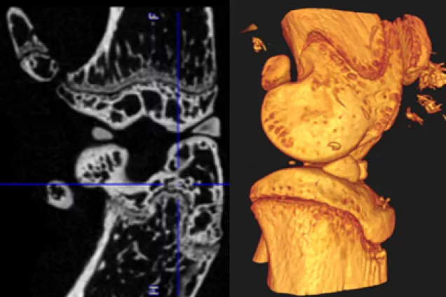 Micro-CT image of a knee joint and a 3D visualisation of the same knee. 